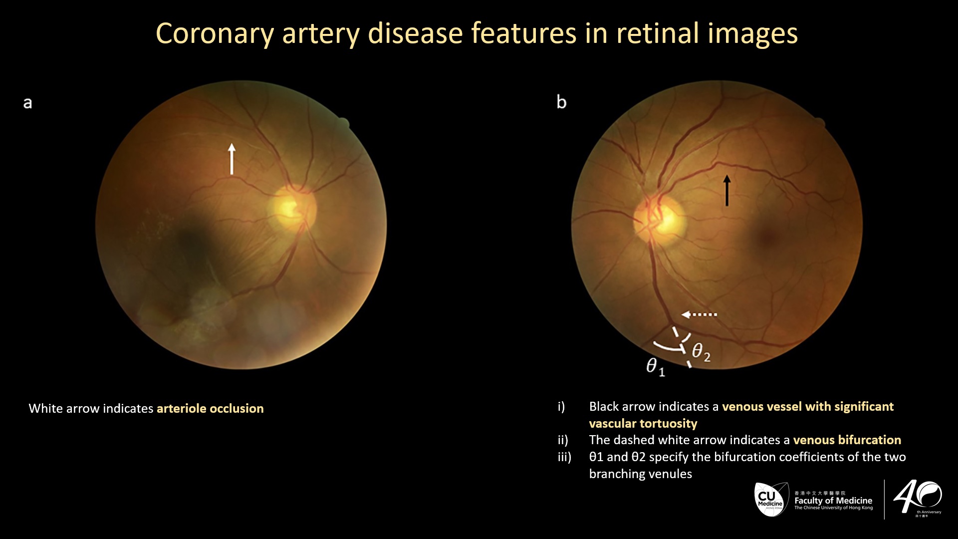 retinal images